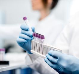 Diagnosta bada krew pacjenta pod kątem stężenia wolnej trijodotyroniny FT3.