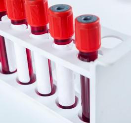 Fiolki zawierające krew do badania morfologii krwi, w tym wskaźnika PDW.