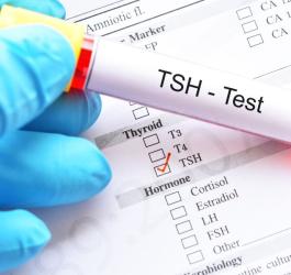 TSH norma - badanie tarczycy