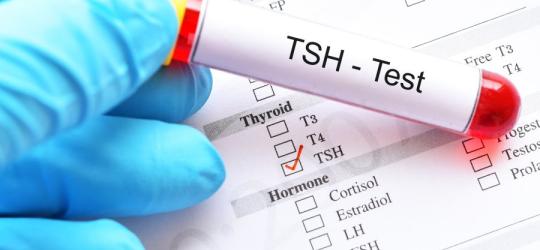 TSH norma - badanie tarczycy