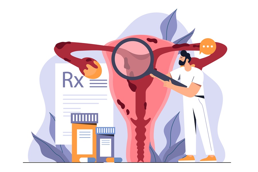 Rysunkowy lekarz diagnozuje adenomiozę w obrębie macicy.