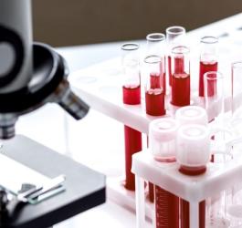 Próbki krwi pobranej do badania stężenia amylazy w surowicy.