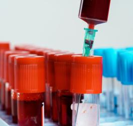 Próbki krwi przeznaczone do badania poziomu apolipoproteiny B.