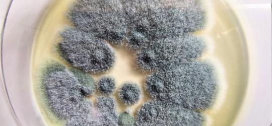 Szalka Petriego z wyhodowanym grzybem Aspergillus, wywołującym aspergilozę.