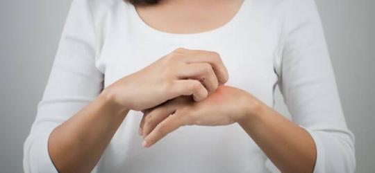 Atopowe zapalenie skóry