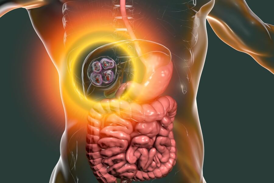 Grafika 3D obrazująca umiejscowienie torbieli z larwami tasiemca bąblowcowego w wątrobie człowieka.