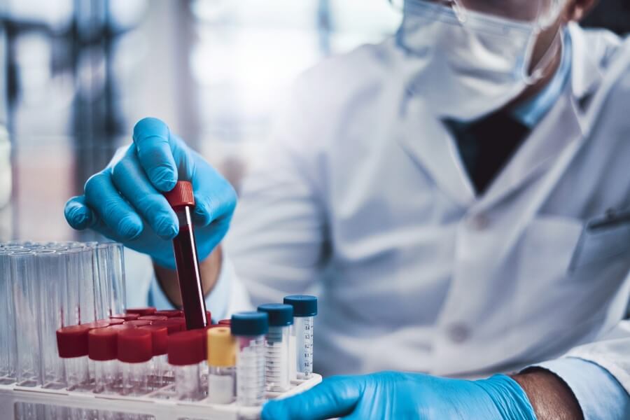 Diagnosta przygotowuje fiolki z krwią do badania APTT.