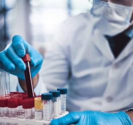 Diagnosta przygotowuje fiolki z krwią do badania APTT.