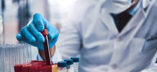 Diagnosta przygotowuje fiolki z krwią do badania APTT.