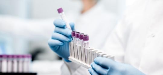 Diagnosta układa próbki krwi przygotowane do badania beta hCG.