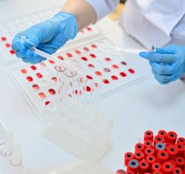 Diagnosta podczas pracy w laboratorium nad próbkami krwi.