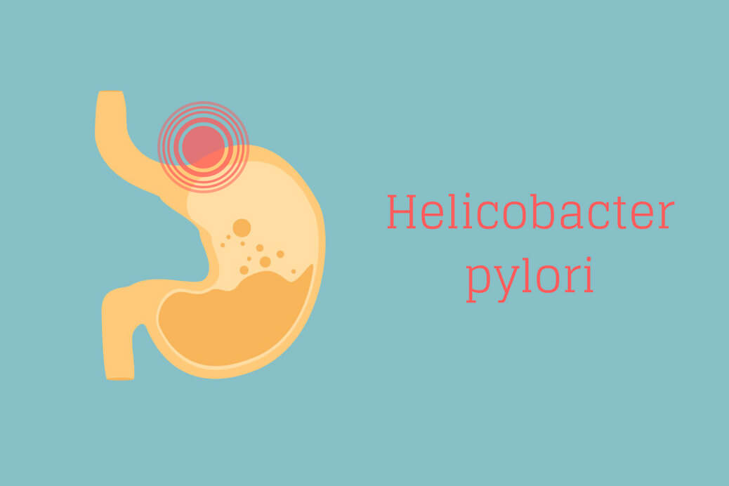 Bakteria helicobacter pylori