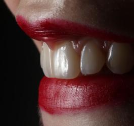 białe plamy na zębach