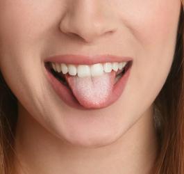 Kobieta pokazuje język z widocznym białym nalotem.