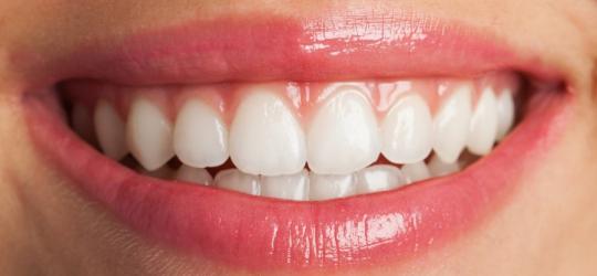 Zbliżenie na zdrowy uśmiech.