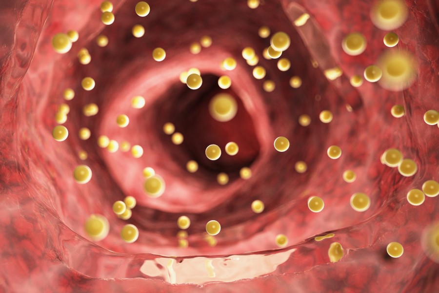 Cholesterol LDL w krwiobiegu.