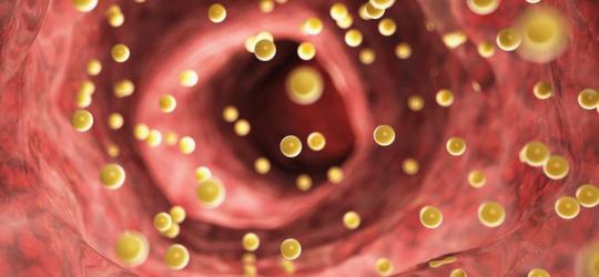 Cholesterol LDL w krwiobiegu.