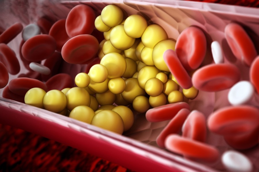 Cząsteczki cholesterolu w krwiobiegu.