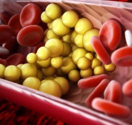 Cząsteczki cholesterolu w krwiobiegu.