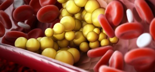 Cząsteczki cholesterolu w krwiobiegu.