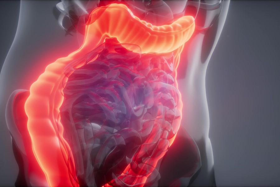 Model 3D ludzkiego jelita, podświetlony na czerwono, co sugeruje chorobę.
