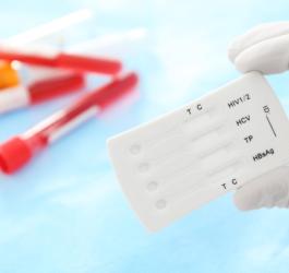 Diagnosta trzyma w ręce test na choroby weneryczne.