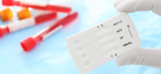 Diagnosta trzyma w ręce test na choroby weneryczne.