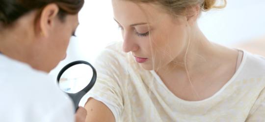 Czerniak: przyczyny, objawy i metody leczenia