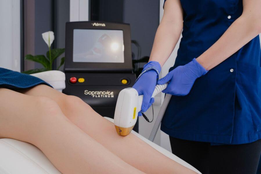 depilacja laserowa