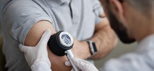 Dermatolog wykonuje u pacjenta dermatoskopię.