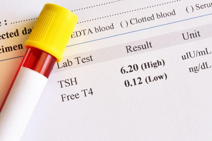 FT4 - badanie hormonu tarczycy