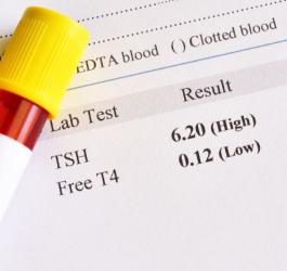 FT4 - badanie hormonu tarczycy