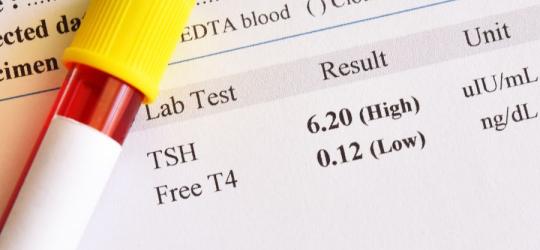 FT4 - badanie hormonu tarczycy