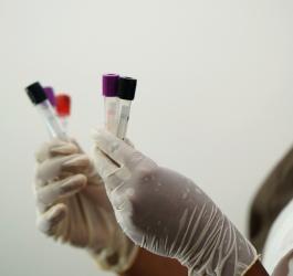 Gdzie diagnozować, leczyć boreliozę?