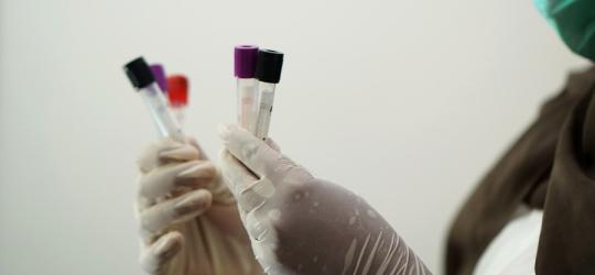 Gdzie diagnozować, leczyć boreliozę?