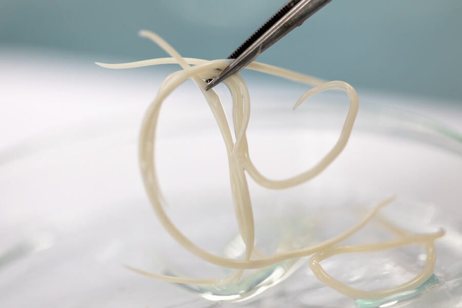 Glista ludzka - objawy, leczenie, badanie na pasożyty