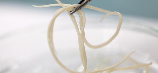 Glista ludzka - objawy, leczenie, badanie na pasożyty