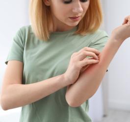 Kobieta drapie się po przedramieniu, skóra jest zaczerwieniona.