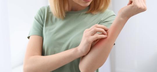 Kobieta drapie się po przedramieniu, skóra jest zaczerwieniona.