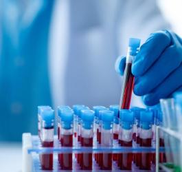 Diagnosta wyciąga próbkę krwi pacjenta, przeznaczoną do zbadania stężenia hematokrytu (HTC).