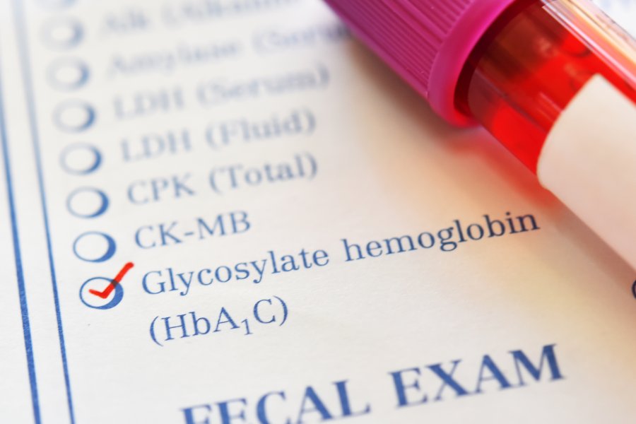 Hemoglobina glikowana