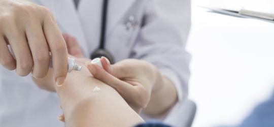 Hydrokortyzon na alergię i nie tylko