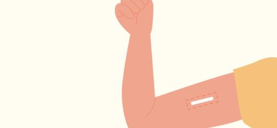 Rysunkowe ramię z widocznym implantem antykoncepcyjnym.