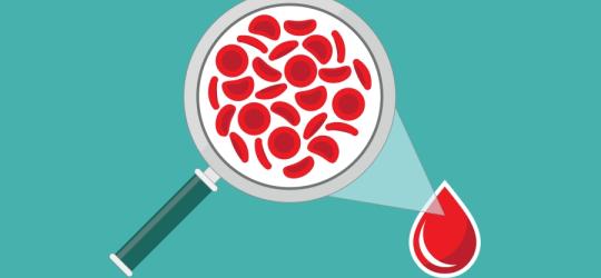 Jak diagnozować anemię?