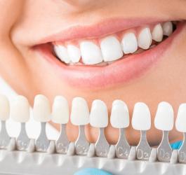 Jak wybielić zęby?