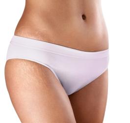 Jak zlikwidować rozstępy?