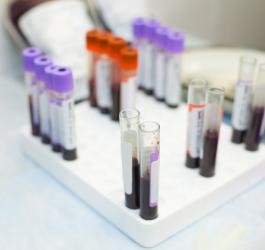 Próbki krwi przeznaczone do badania poziomu kinazy kreatynowej.