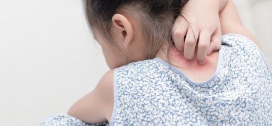 Liszaj u dziecka - jak wygląda i jak go leczyć?