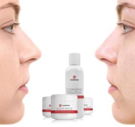 Twarz kobiety przed i po używaniu kosmetyków na trądzik różowaty.