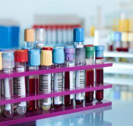 Fiolki z próbkami krwi pacjentów, przeznaczone m.in. do morfologii krwi i oceny stężenia monocytów.